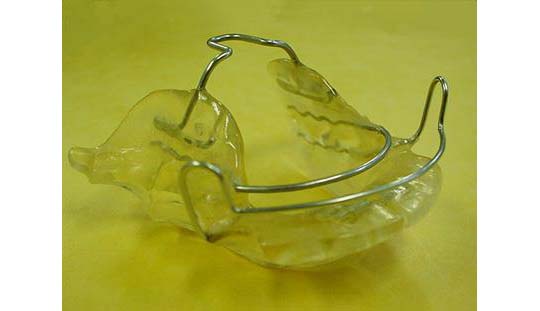 機能性不正咬合とはどんな状態か 成り立ちや診断 治療方法について ドクターズブログ 舌側矯正のアイ矯正歯科クリニック